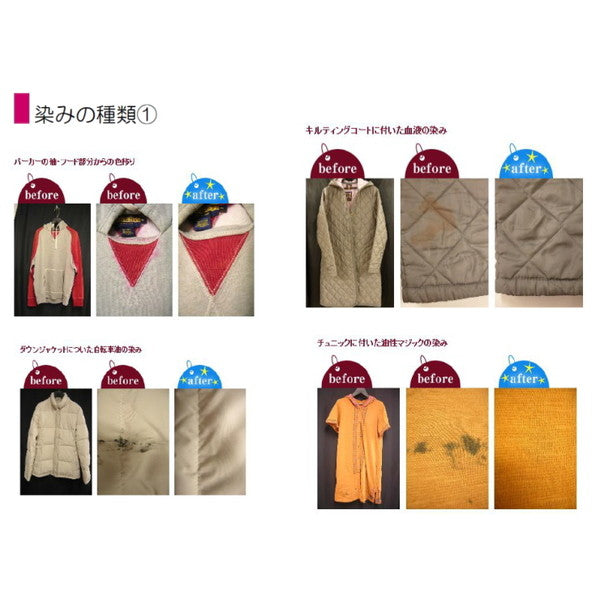 衣類のクリーニング・保管・匠のしみ抜き 美服パック 20点 プレミアムセット［ECO］